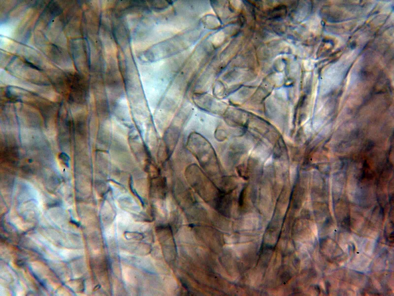 Arrhenia spathulata 5 - Hifas cutícula 2